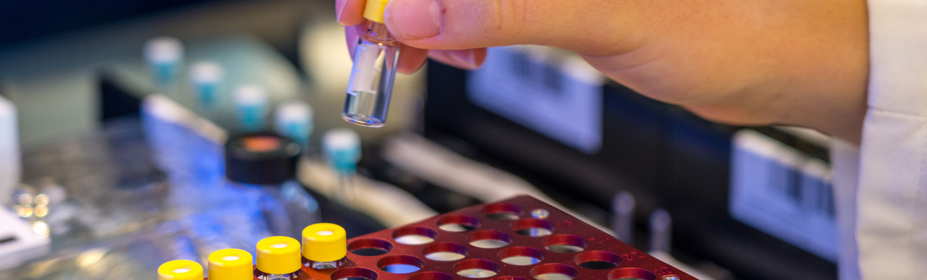 A hand holding a test tube with a yellow cap in a laboratory setting. A row of test tubes sitting in a red coloured rack can be seen in the foreground. A row of test tubes with white lids can be seen in the background.