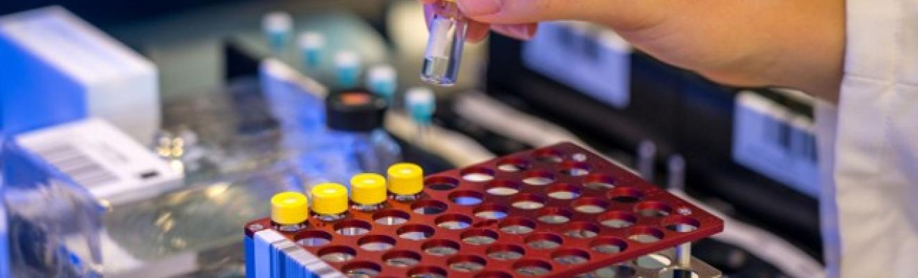 Close-up of a hand holding a small glass vial with a yellow cap, with blurred laboratory equipment in the background.