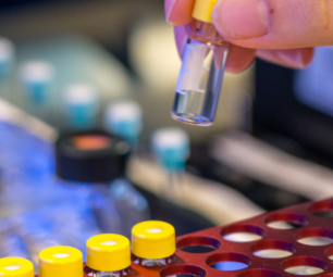 A hand holding a test tube with a yellow cap in a laboratory setting. A row of test tubes sitting in a red coloured rack can be seen in the foreground. A row of test tubes with white lids can be seen in the background.