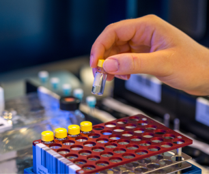 A hand holds a test sample tube above a rack containing four other test samples during sports drug testing.