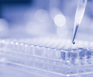 Lab technician injecting liquid into a microtiter plate