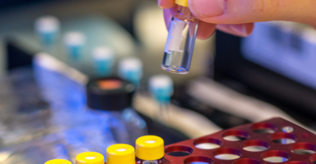 A hand holding a test tube with a yellow cap in a laboratory setting. A row of test tubes sitting in a red coloured rack can be seen in the foreground. A row of test tubes with white lids can be seen in the background.