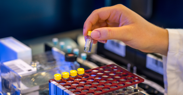 A hand holds a test sample tube above a rack containing four other test samples during sports drug testing.